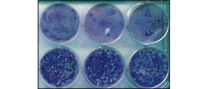 Вакцина проти деменції цілком може вже існувати