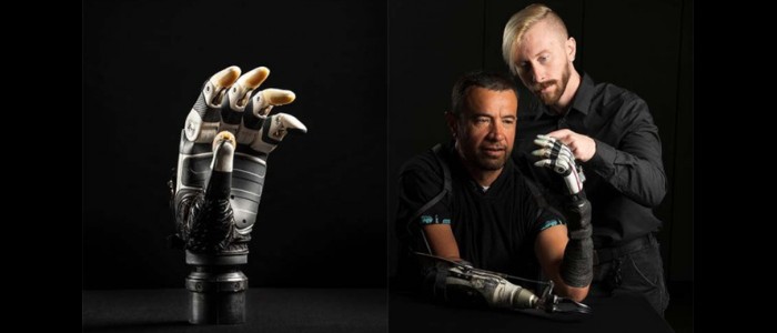 Ручний протез зі штучним інтелектом інтуїтивно захоплює предмети