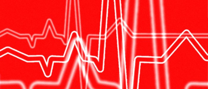 Цей штучний інтелект може виявити низький рівень цукру в крові за показаннями ЕКГ