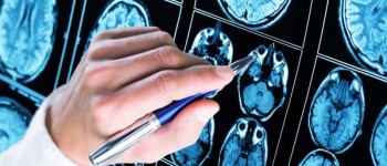 Алкоголь переводить мозок у фрагментований та локалізований стан