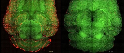 Лікування наночастинками виліковує хворобу Альцгеймера у мишей